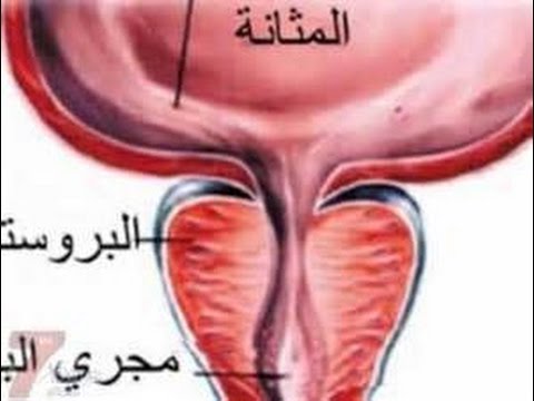 علاج البروستاتا