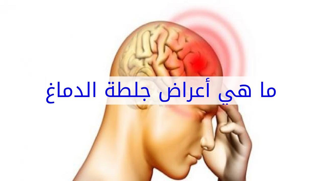 أعراض جلطة الدماغ