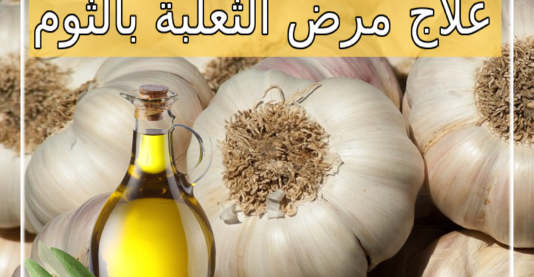 علاج مرض الثعلبة بالثوم