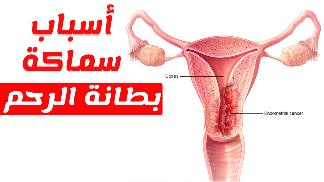 أسباب سماكة بطانة الرحم