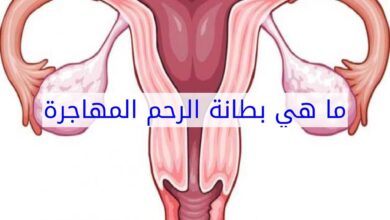 ما هي بطانة الرحم المهاجرة