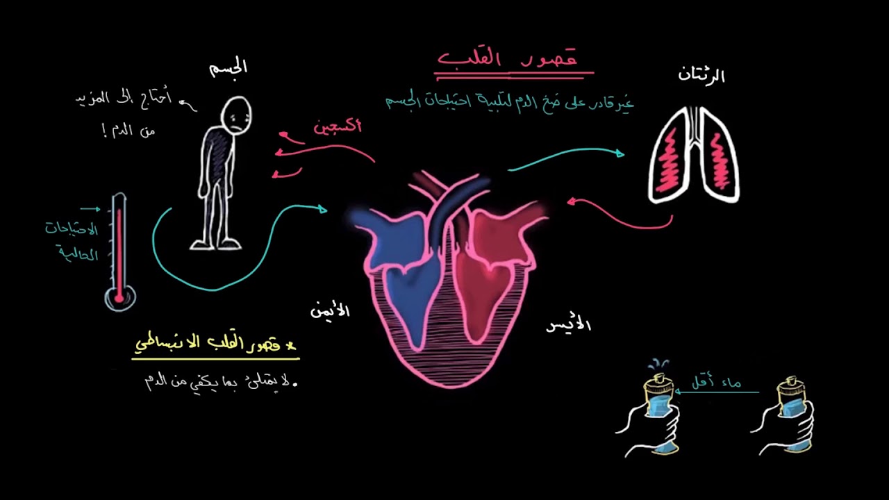 صورة توضح قصور القلب