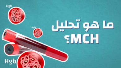 معلومات عن تحليل mch