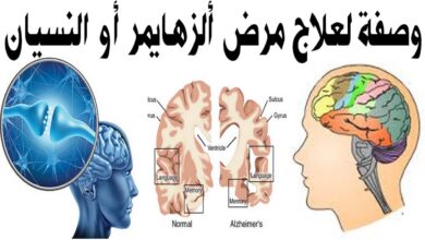 وصفة لعلاج مرض الزهايمر