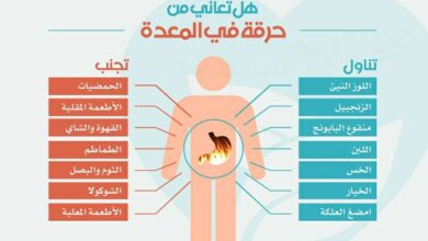 أسباب حرقة المعدة