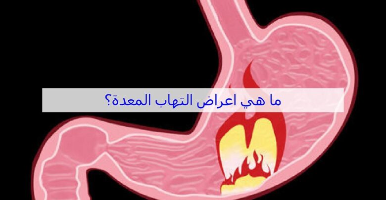 ماهي أعراض التهاب المعدة