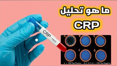 ماهو تحليل crp