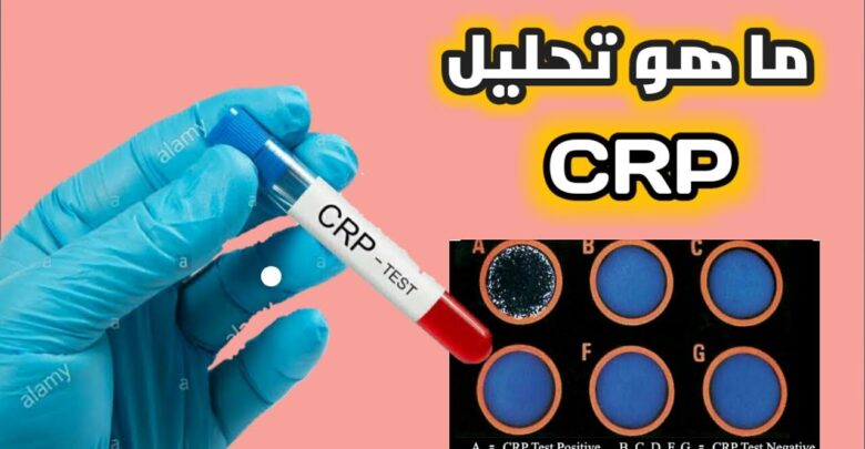 ماهو تحليل crp