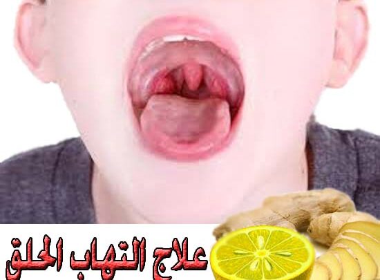 علاج التهاب الحلق