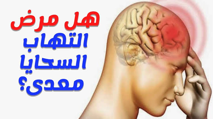 هل مرض التهاب السحايا معدي