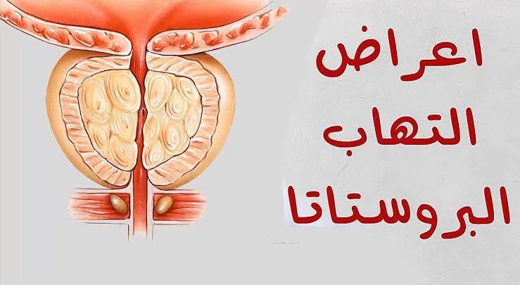 أعراض البروستاتا