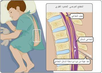 العمود الفقري والسحايا