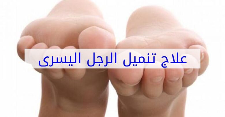 علاج تنميل الرجل اليسرى