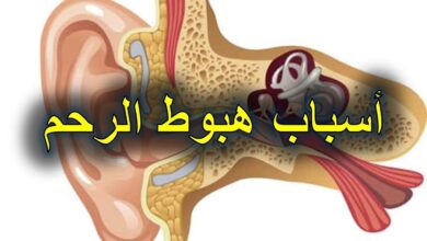 أسباب هبوط الرحم