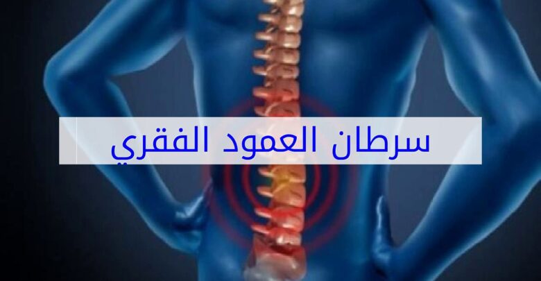 أمراض العمود الفقري