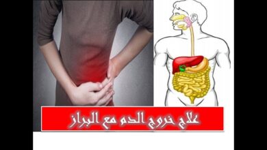 علاج خروج الدم مع البراز