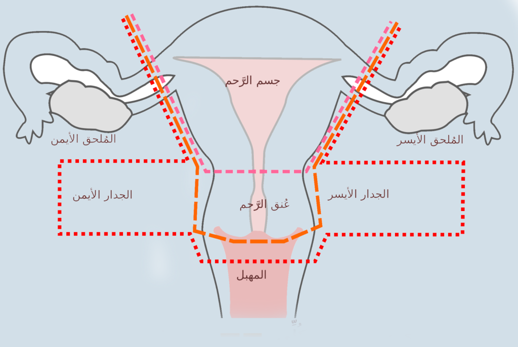 نزول الرحم.