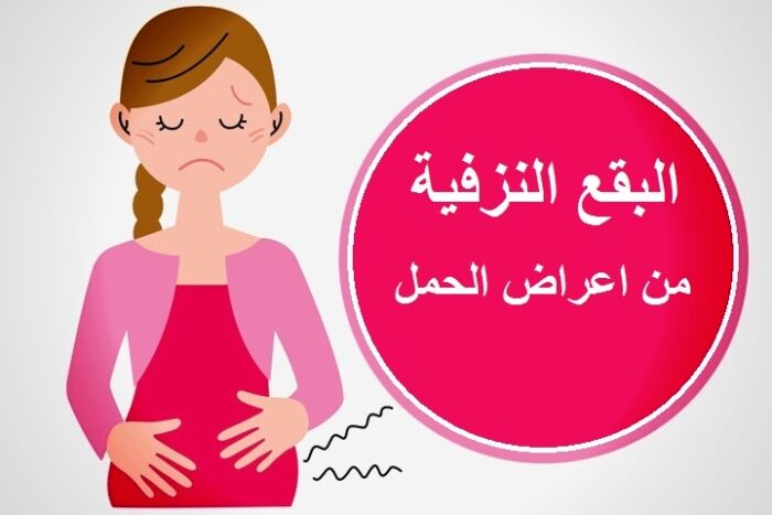 التبقيع من أعراض الحمل