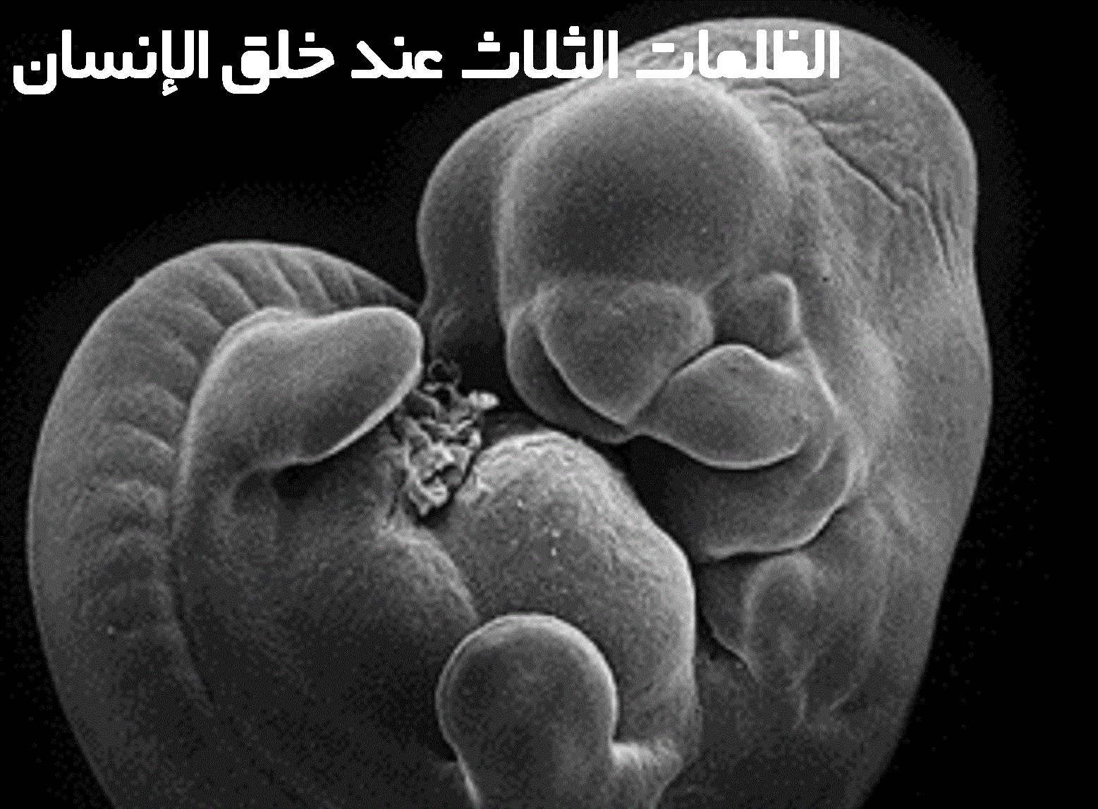 الظلمات الثلاث