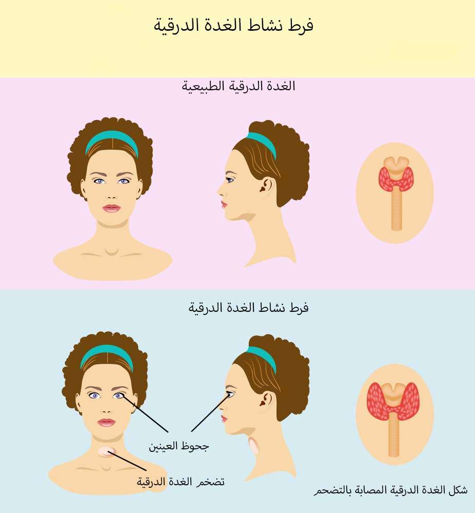 معلومات طبية