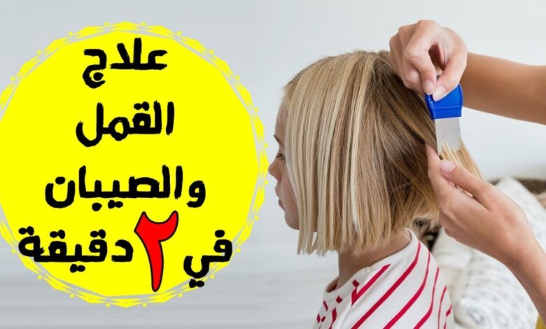 علاج القمل في دقيقتين