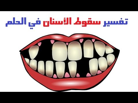 تفسير حلم سقوط سن واحد لابن لاسيرين